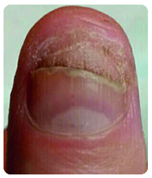 Mizoril